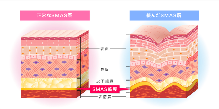 顔がたるむワケ