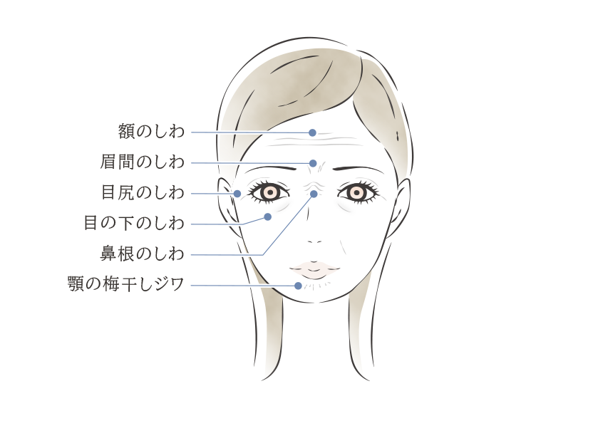 ボトックスの注入部位