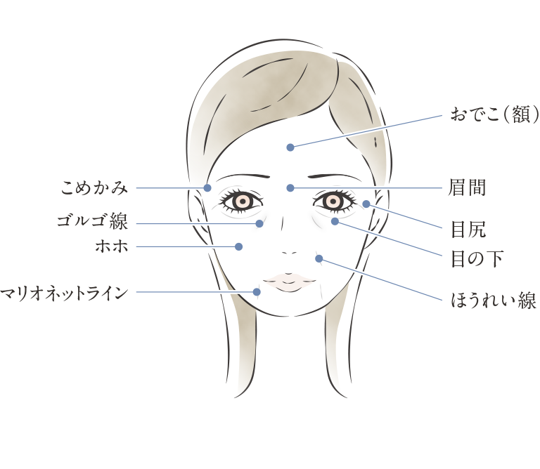 ヒアルロン酸の注入部位