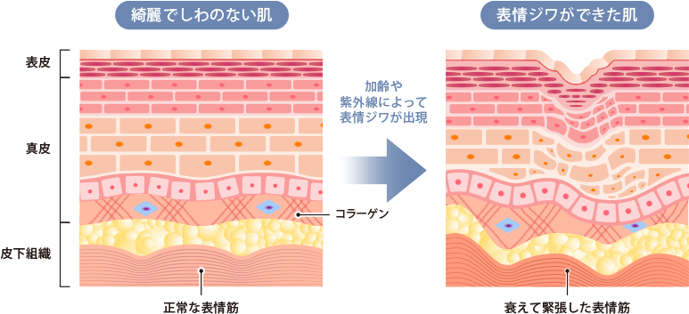 綺麗でしわのない肌 表情ジワができた肌