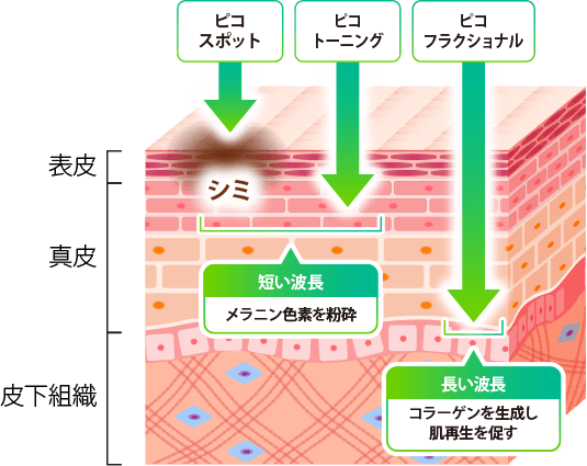 3つの治療