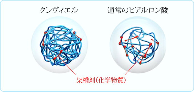 クレヴィエルと通常のヒアルロン酸の比較