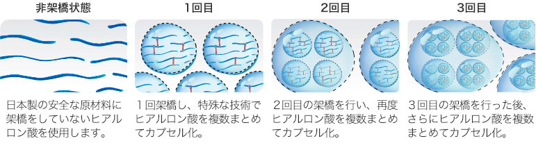 ピネハウルトラとは