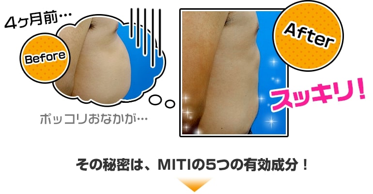 MITIのビフォーアフター