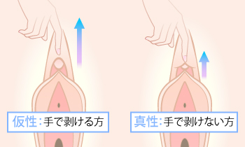 クリトリスが仮性か真性か調べる方法