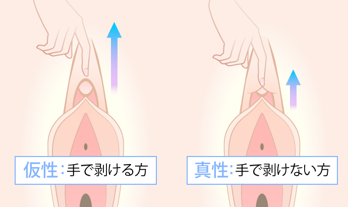 クリトリスが仮性か真性か調べる方法