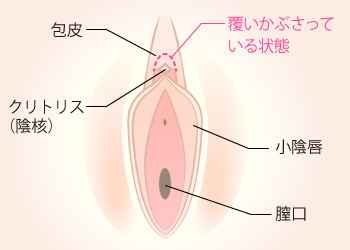 クリトリス（陰核）の説明図