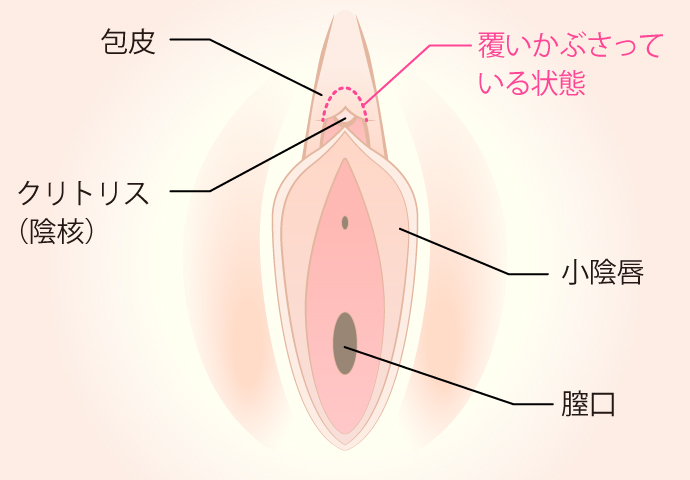 クリトリス（陰核）の説明図