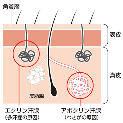 アポクリン汗腺とエクリン汗腺