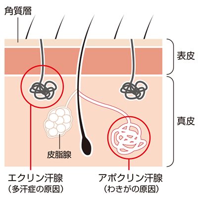 アポクリン汗腺とエクリン汗腺