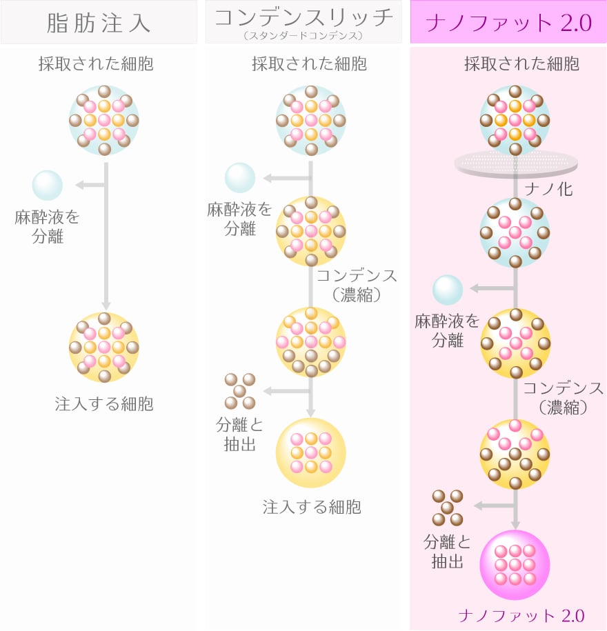 ナノファット2.0と従来の脂肪注入、コンデンスリッチとの違い
