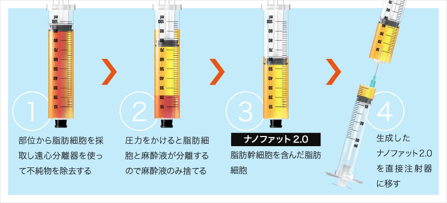 良質な脂肪細胞のみを抽出したナノファット2.0