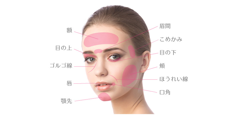 脂肪注入が可能な部位（おでこ・頬・ほうれい線・唇・顎など）
