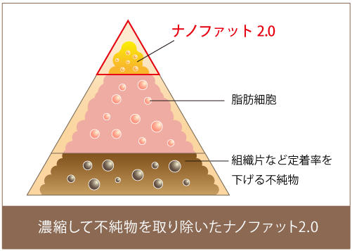 脂肪注入に用いるナノファット2.0