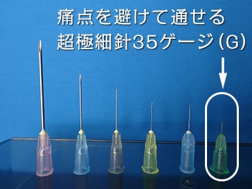 TCBで使用する局所麻酔は、痛点を避けて通せる超極細針35ゲージ（G）を使用しています