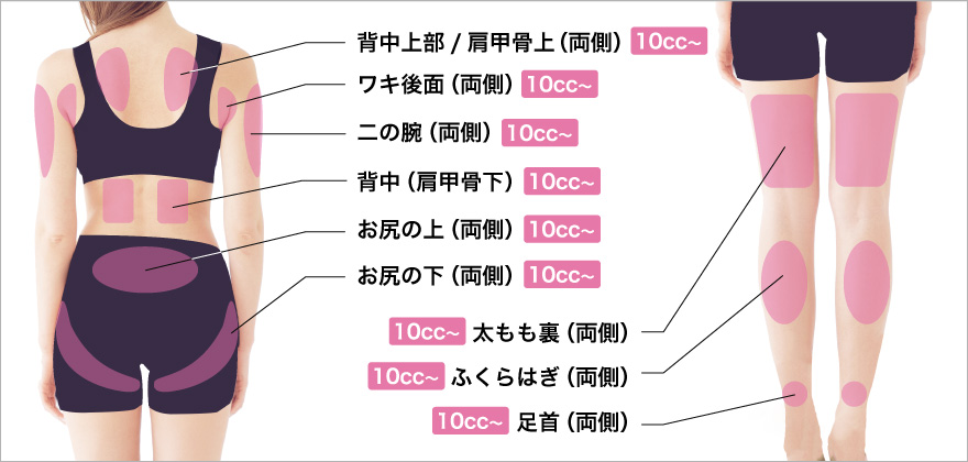 脂肪溶解注射（BNLS アルティメット）身体背面、足治療部位