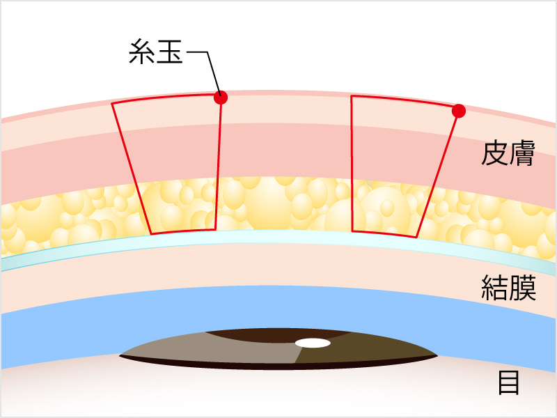 新・クイックデカ目グレード ナチュラル