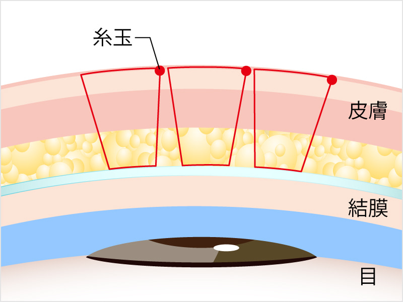 新・クイックデカ目プレミアムエタニティ