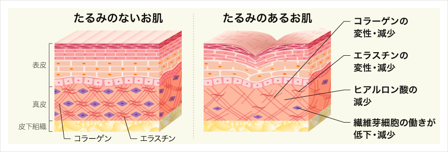 お肌のハリ・弾力の低下
