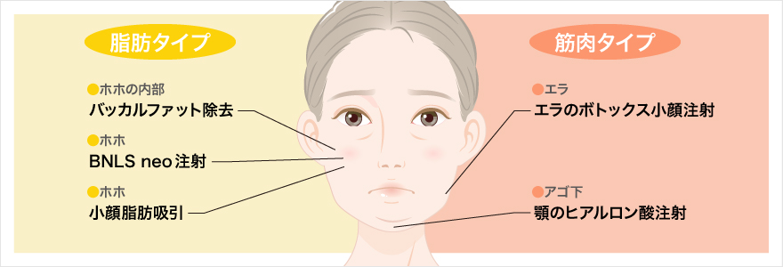 お顔が大きくみえる原因は筋肉タイプ・脂肪タイプの2種類