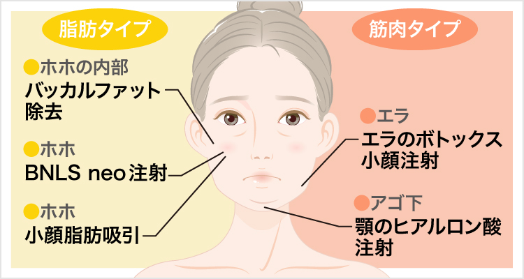 お顔が大きくみえる原因は筋肉タイプ・脂肪タイプの2種類