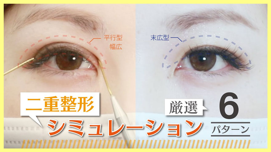 【実例】二重デザイン シミュレーション~6名一挙公開~【平行/末広】