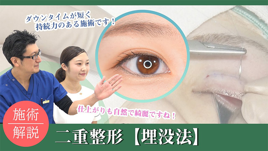 【二重整形】ぱっちり平行型二重に！長持ち＆ダウンタイムが短い埋没法【施術解説】