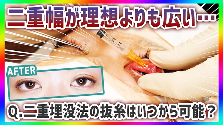 【二重埋没】その二重埋没法は本当に失敗？ 正しいダウンタイムの経過の見方を美容外科医が徹底解説！【二重整形 抜糸】