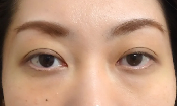 茶クマ before