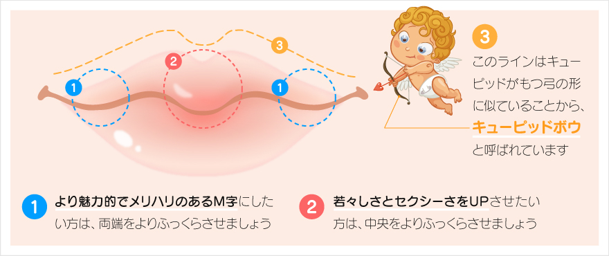 ヒアルロン酸注射でキューピッドボウを形成