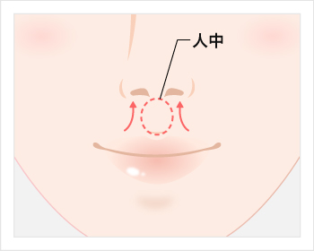 人中短縮術のイメージ図