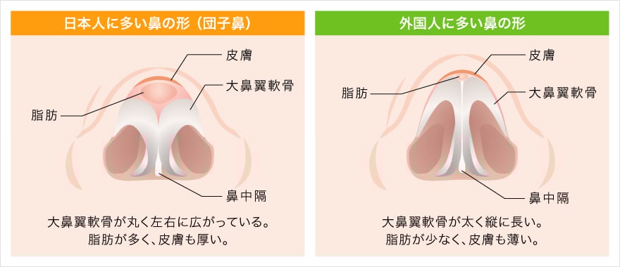 鼻尖形成完全閉鎖法が優れている理由